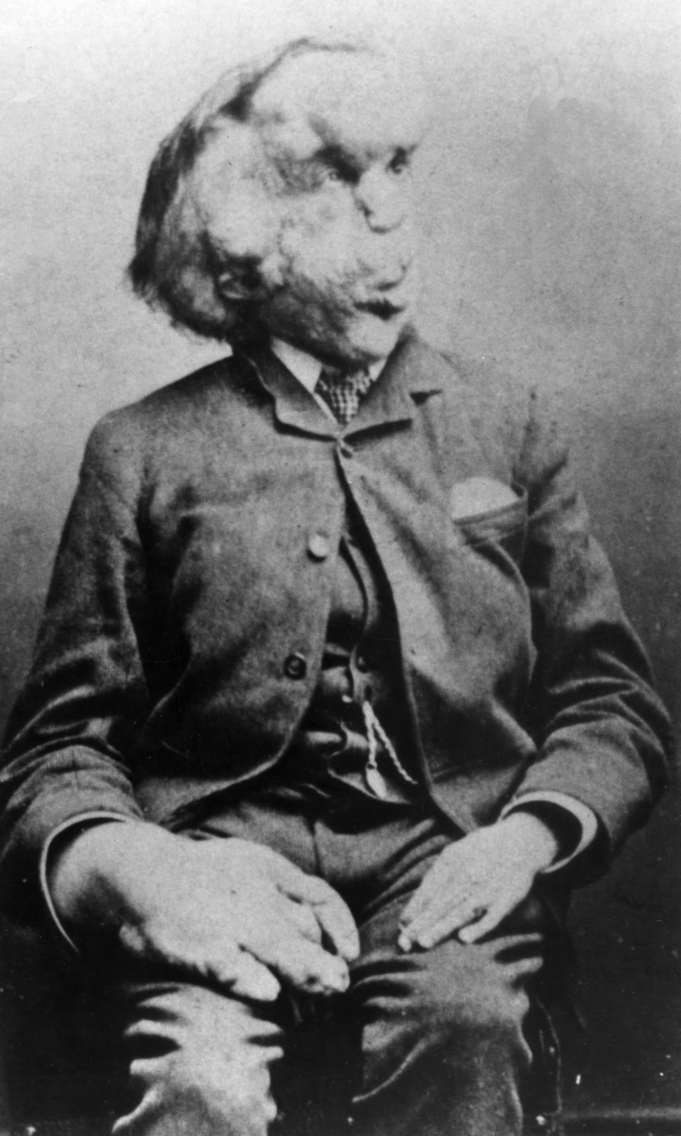 Joseph Merrick, Artiste