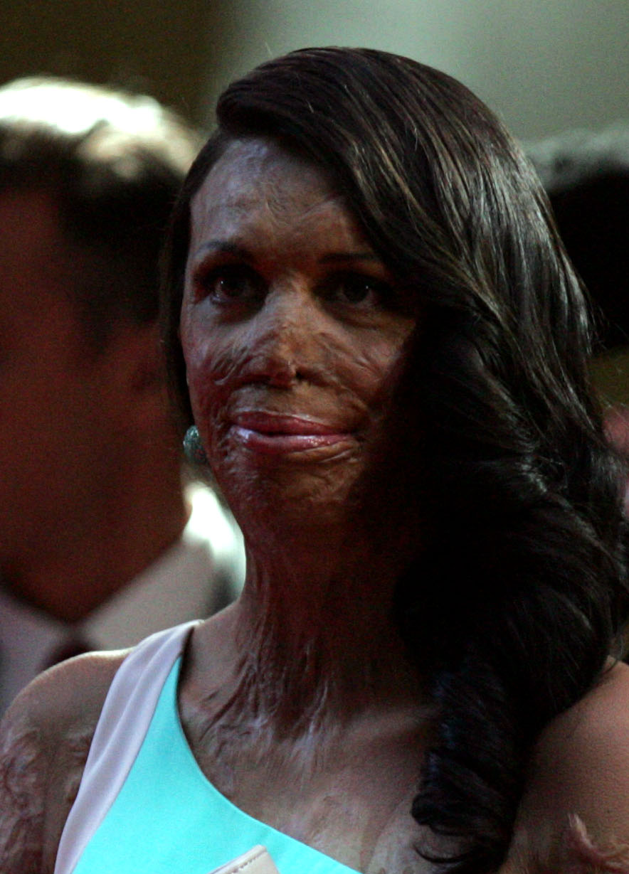Turia Pitt, Scientifique